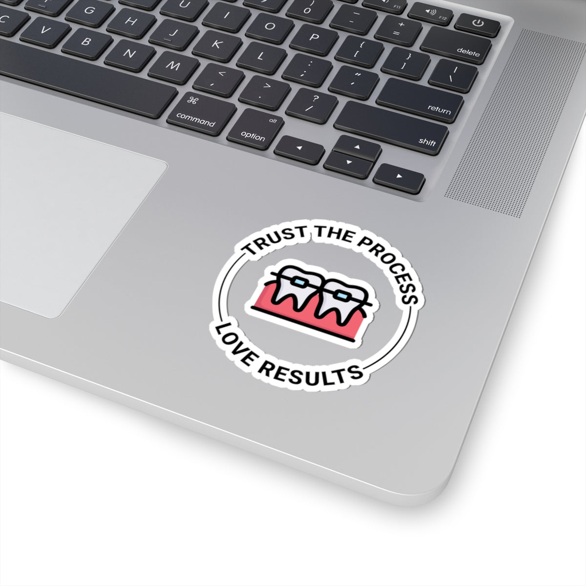 Trust The Process Sticker - Orthodontic Motivation Vinyl Decal for Braces Results
