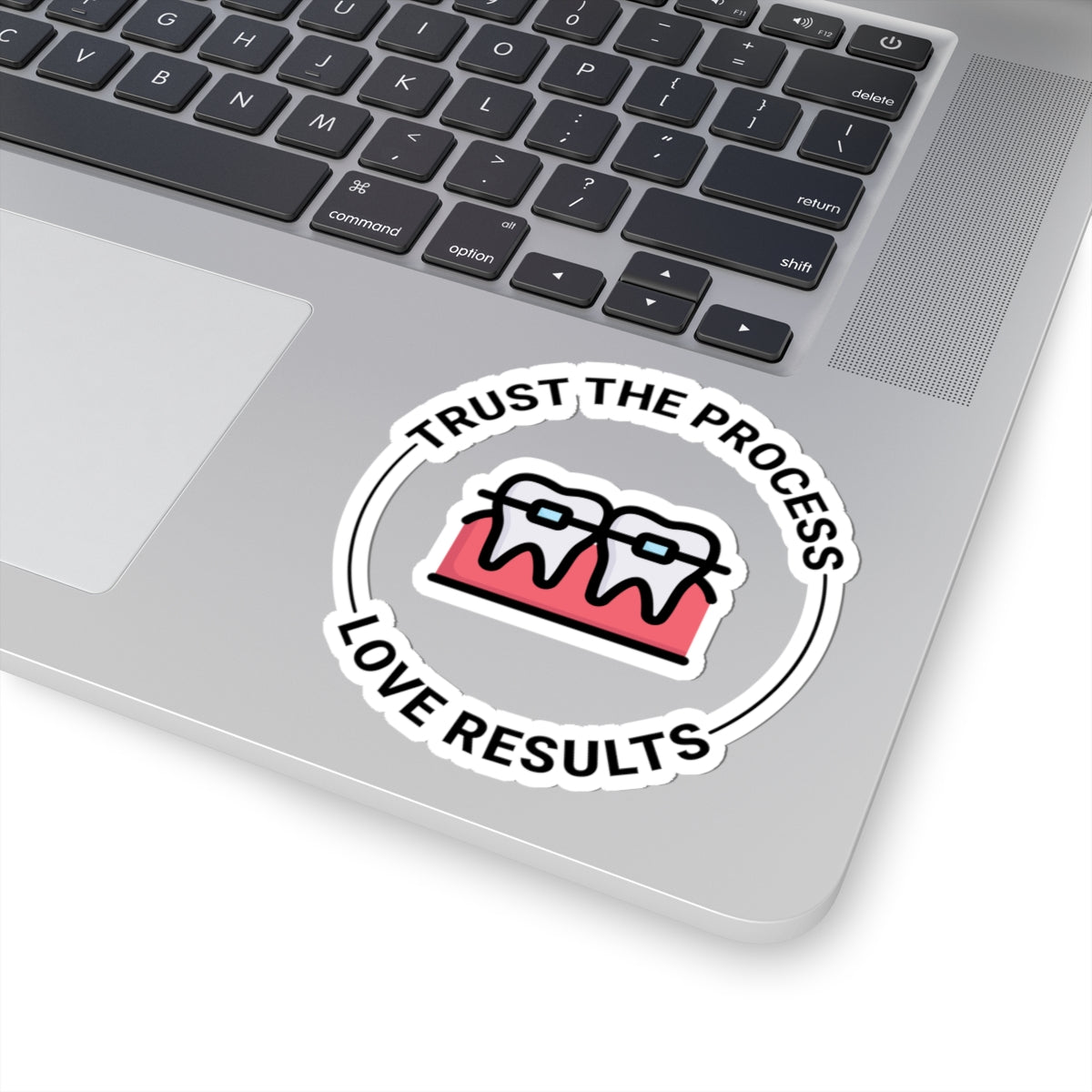 Trust The Process Sticker - Orthodontic Motivation Vinyl Decal for Braces Results